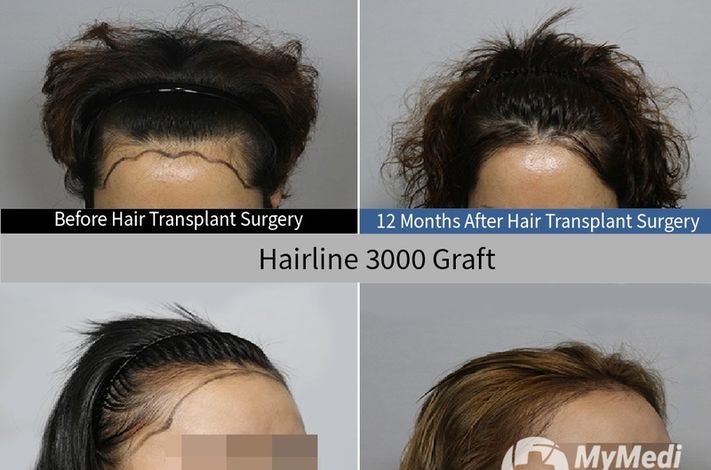 Moaman Hair Transplant Clinic