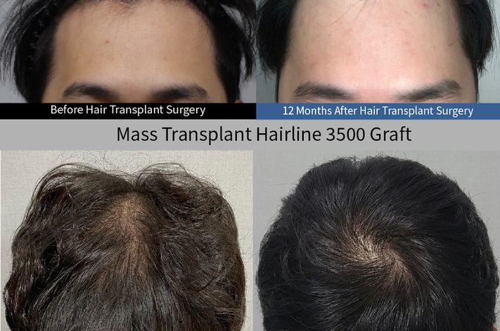 Moaman Hair Transplant Clinic