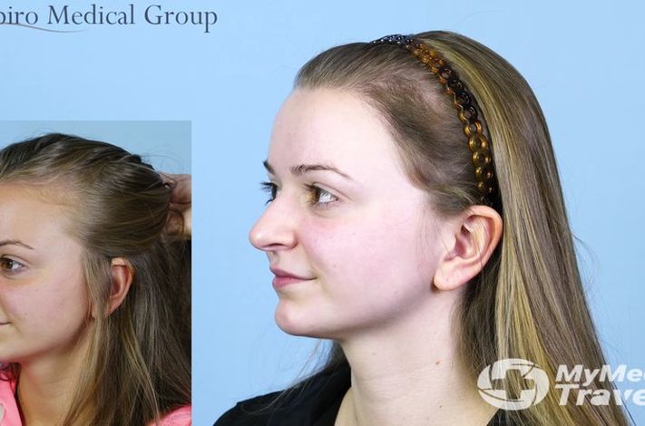 Shapiro Medical Group | Hair Restoration | Minneapolis, MN