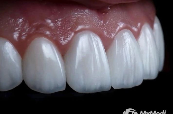 DR MERT AKBAS DENTAL CLINIC ISTANBUL- MAXILLOFACIAL SURGERY CENTRE