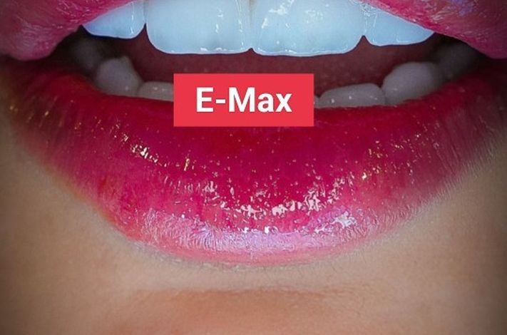 DR MERT AKBAS DENTAL CLINIC ISTANBUL- MAXILLOFACIAL SURGERY CENTRE