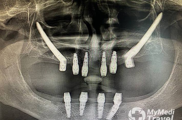 DR MERT AKBAS DENTAL CLINIC ISTANBUL- MAXILLOFACIAL SURGERY CENTRE