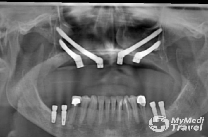 DR MERT AKBAS DENTAL CLINIC ISTANBUL- MAXILLOFACIAL SURGERY CENTRE