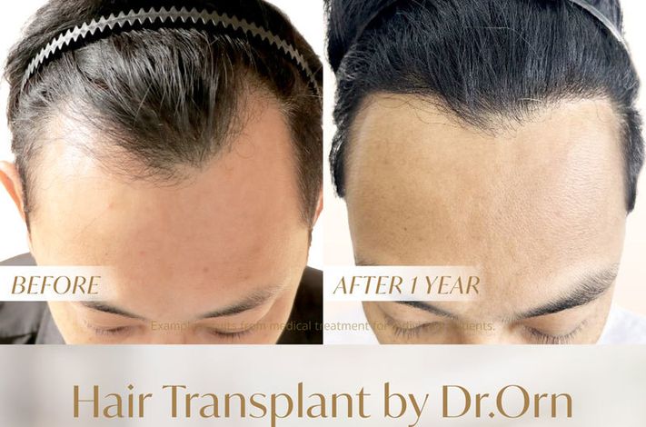 Dr. Orn Medical Hair Center