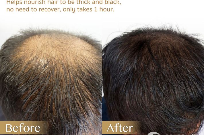 Dr. Orn Medical Hair Center