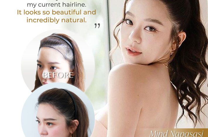 Dr. Orn Medical Hair Center