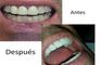 Sonrisa Perfecta Dental-Tarsys Loayza Roys