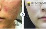 Renewme Skin Clinic Hwagok