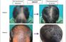 Dermasculpt Skin and Hair Clinic