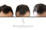 Doctor Hair Clinic - FUE Hair Transplant Clinic Hungary