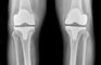 Joint Replacement & Sports injury Clinic