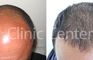 Clinic Center - Hair Transplant Clinic Turkey