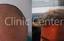 Clinic Center - Hair Transplant Clinic Turkey
