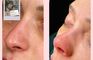 The Nose Aesthetic Clinic - Dr. Cem Altindag