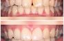 Smilesplace Dental Clinic D.KOTSIRIS,DDS,MSc A.GKIONI, DDS, MScEndo