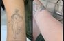 PHU TON - Laser Tattoo Removal