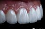 DR MERT AKBAS DENTAL CLINIC ISTANBUL- MAXILLOFACIAL SURGERY CENTRE